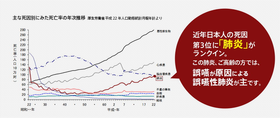 近年日本の死因第三位に「肺炎」がランクイン。この肺炎、ご高齢の方では、誤嚥が原因による誤嚥性肺炎が主です。