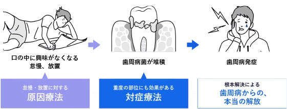 怠慢、放置→歯周病菌が堆積→歯周病発症