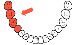 歯形のうち1ブロックを示す図